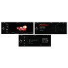 Магнитола FarCar s200 для BMW 5 на Android 7.1 (B3004-CIC)
