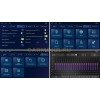 Штатная магнитола Unison QL586M для Hyundai H1 Starex II 2016-2022 на Android 10.0